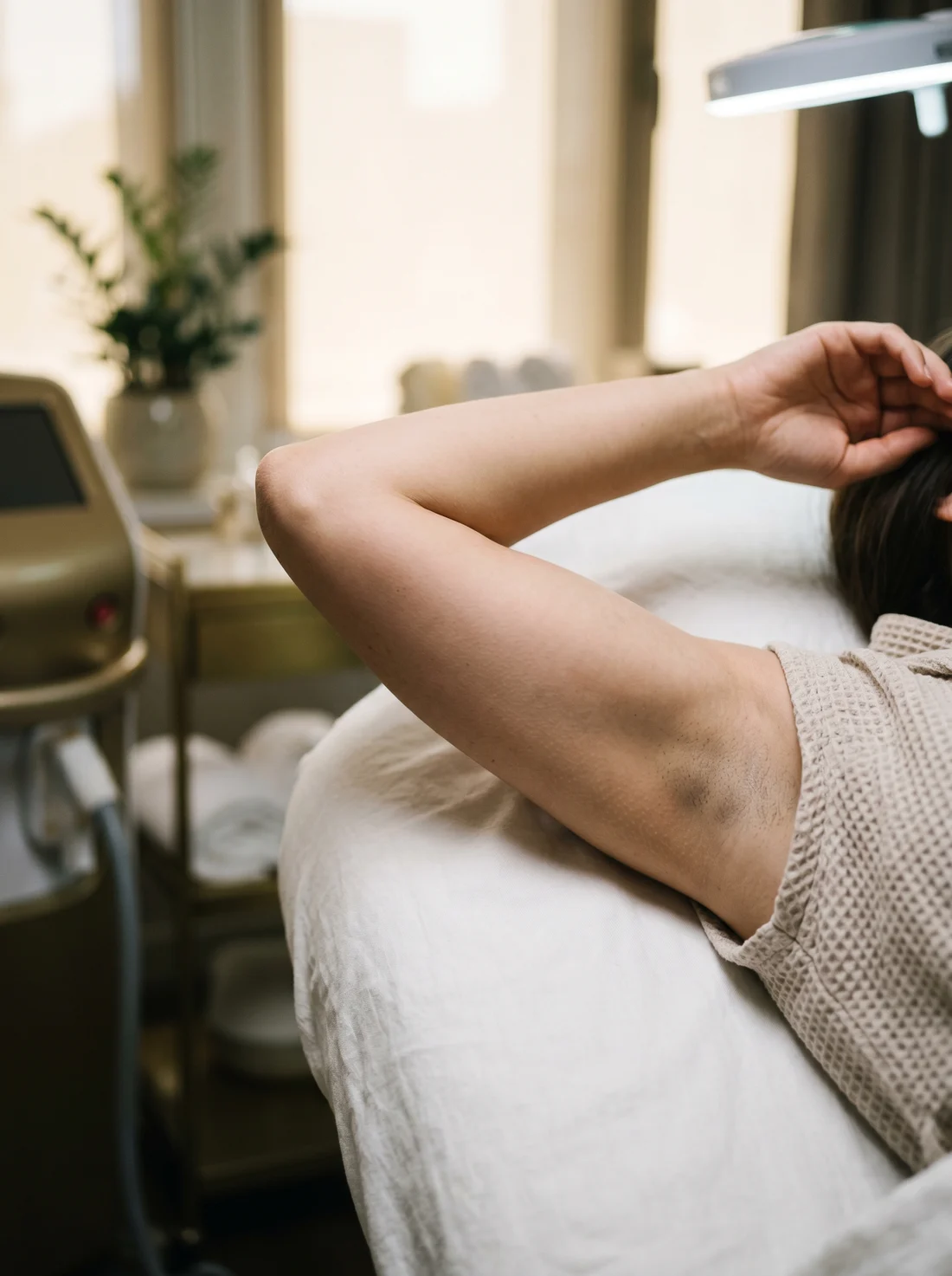 Pielea înainte de epilarea laser